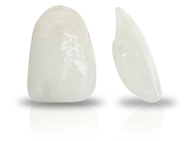 Porcelain Veneers Dental Care Solutions