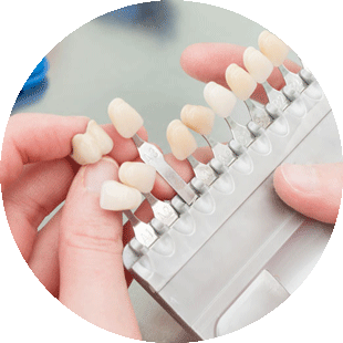 Doctor Holding Dental Veneers