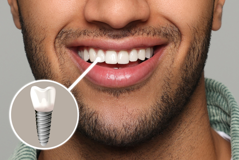 Happy man with perfect teeth smiling on grey background