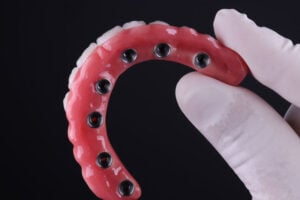 Dental Implants Prosthetic Porcelain Rehabilitation